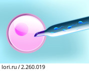 Экстракорпоральное оплодотворение, планирование пола, мальчик - спермии с Y хромосомой. Стоковая иллюстрация, иллюстратор Анастасия Некрасова / Фотобанк Лори