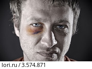 Портрет небритого мужчины с фингалом под глазом. Стоковое фото, фотограф bashta / Фотобанк Лори