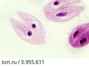 Инфузория-туфелька, парамеция хвостатая (лат. Paramecium caudatum) под микроскопом. Стоковое фото, фотограф Артем Поваров / Фотобанк Лори