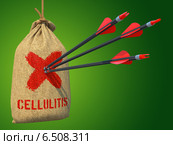 Стрелы в мишени с надписью Cellulitis. Стоковое фото, фотограф Илья Урядников / Фотобанк Лори