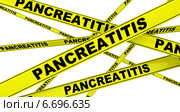 Панкреатит (pancreatitis). Желтая оградительная лента. Стоковая иллюстрация, иллюстратор WalDeMarus / Фотобанк Лори