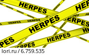 Герпес (herpes). Желтая оградительная лента. Стоковая иллюстрация, иллюстратор WalDeMarus / Фотобанк Лори