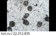 Паразитический червь Echinococcus multilocularis под микроскопом. Стоковое видео, видеограф Руднева Ольга / Фотобанк Лори