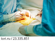 hands of cardiac surgeon at surgery operation. Стоковое фото, фотограф Дмитрий Калиновский / Фотобанк Лори