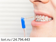 Man using interdental brush for orthodontic braces. Стоковое фото, фотограф Сергей Новиков / Фотобанк Лори