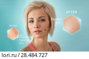 Bright closeup portrait of beautiful woman with skin crops. Skincare concept. Стоковое фото, фотограф Kirill Kedrinskiy / Ingram Publishing / Фотобанк Лори