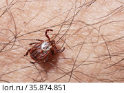 Blood-sucking mite on a human skin macro. Стоковое фото, фотограф Георгий Дзюра / Фотобанк Лори