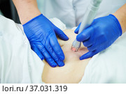 Laser cosmetic surgery and skin resurfacing in dermatology. Стоковое фото, фотограф Дмитрий Калиновский / Фотобанк Лори