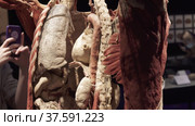 Human skeleton with removed skin and internal organs (2021 год). Редакционное видео, видеограф Потийко Сергей / Фотобанк Лори