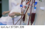 System of filters and tubes of the hemodialysis machine. Process of cleaning the blood from toxins. Стоковое видео, видеограф Константин Мерцалов / Фотобанк Лори