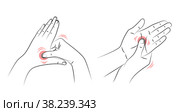 Self-massage of palms of hands, close-up. Human presses special points on palm to relieve headaches and other pains. Health and wellness acupressure manipulations. Alternative medicine, reflexology. Самомассаж ладоней рук, крупный план. Человек нажимает на специальные точки на ладони, чтобы облегчить головную и другие боли. Акупрессурные манипуляции для здоровья и хорошего самочувствия. Альтернативная медицина, рефлексотерапия. Стоковая иллюстрация, иллюстратор Dmitry Domashenko / Фотобанк Лори