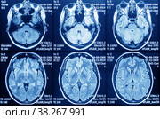 MRI of the brain for diagnosis. Medical examination for the prevention of the disease. Стоковое фото, фотограф Светлана Акифьева / Фотобанк Лори