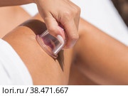 Концепция красоты и здорового тела. Женщина делает массаж бедер вакуумной банкой для антицеллюлитного массажа. Крупный план на светлом фоне. Средства для разглаживания кожи. Стоковое фото, фотограф Photojuli / Фотобанк Лори