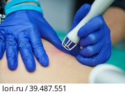 Laser cosmetic surgery and skin resurfacing in dermatology. Стоковое фото, фотограф Дмитрий Калиновский / Фотобанк Лори