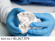 Руки зубного техника врача в медицинских голубых защитных перчатках держат зубной слепок челюсти, показывают прикус для протезирования. Стоковое фото, фотограф Татьяна Радевич / Фотобанк Лори