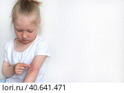 Ребенок чешет атопичную кожу. Дерматит, диатез, аллергия на теле ребенка. Стоковое фото, фотограф Терехова Марина / Фотобанк Лори