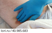 Hematoma on a men's leg close-up. Huge bruise on the leg of a man after endovascular repair due to taking blood thinning medication drugs. Doctor's hand in blue gloves examining patient. Hemorrhage. Стоковое видео, видеограф Марина Демидюк / Фотобанк Лори
