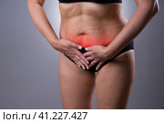 Woman with menstrual pain, endometriosis or cystitis, stomach ache. Стоковое фото, фотограф Станислав Тарко / Фотобанк Лори