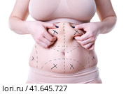 Liposuction, fat and cellulite removal concept, overweight female body with painted lines and arrows. Стоковое фото, фотограф Станислав Тарко / Фотобанк Лори