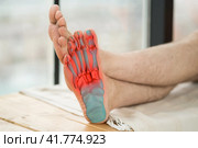 Joint diseases, hallux valgus, plantar fasciitis, man's leg hurts, pain in the foot. Стоковое фото, фотограф Станислав Тарко / Фотобанк Лори