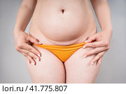 Female belly with a scar from a caesarean section close-up on a gray background. Стоковое фото, фотограф Станислав Тарко / Фотобанк Лори