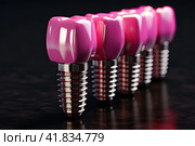 Dental implant and ceramic crown. Medically accurate tooth 3D illustration. Стоковое AI-изображение, AI-художник Ирина Михайличенко / Фотобанк Лори