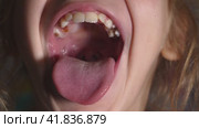 The girl opens her mouth wide and sticks out her long tongue. Child shows her teeth and soft palate. Mouth wide open, tongue stuck out as far as possible. Close-up. Стоковое видео, видеограф Воловодов Владимир / Фотобанк Лори