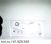 Slices of the tumor under glass. Histological examination of tumor cells for the presence of cancer. Стоковое фото, фотограф Леонид Еремейчук / Фотобанк Лори