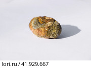 Stone of gallbladder. The result of gallstones. A calculus of heterogeneous composition. Стоковое фото, фотограф Леонид Еремейчук / Фотобанк Лори