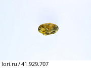 Large gallstone, Gall bladder stone. result of gallstones. Calculus of heterogeneous composition. Стоковое фото, фотограф Леонид Еремейчук / Фотобанк Лори