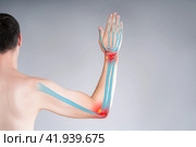 Carpal tunnel syndrome, diseases of the elbow joint, bone fracture and inflammation, man suffering from pain in cubit. Стоковое фото, фотограф Станислав Тарко / Фотобанк Лори