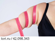 Sagging flabby skin on a woman's arm. Стоковое фото, фотограф Станислав Тарко / Фотобанк Лори
