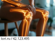 Knee pain, joint inflammation, bone fracture, woman suffering from osteoarthritis, leg injury, AI Generated. Стоковое AI-изображение, AI-художник Станислав Тарко / Фотобанк Лори