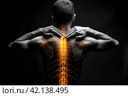 Shoulder-scapular periarthritis, shoulder blades and neck pain, intervertebral spine hernia, man with back pain on a black background, spinal disc disease, AI Generated. Стоковое AI-изображение, AI-художник Станислав Тарко / Фотобанк Лори