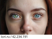 Eyes heterochromia girl. Generate Ai. Стоковое AI-изображение, AI-художник Иван Рябоконь / Фотобанк Лори
