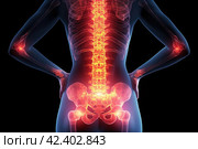Hip joint pain, lumbar spine hernia, human body with osteoarthritis on a black background, health problems concept, AI Generated. Стоковое AI-изображение, AI-художник Станислав Тарко / Фотобанк Лори