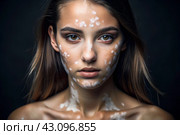 Leukoderma. Vitiligo. Violation of skin pigmentation. Large white spots all over the body and face. Portrait of a beautiful girl with a skin disease. Стоковое AI-изображение, AI-художник Photojuli / Фотобанк Лори