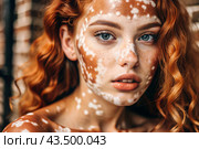 Leukoderma. Vitiligo. Violation of skin pigmentation. Large white spots all over the body and face. Portrait of a beautiful girl with a skin disease. Стоковое AI-изображение, AI-художник Photojuli / Фотобанк Лори
