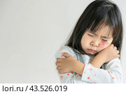 Грустная девочка с атопическим дерматитом и расчесом на лице, псориаз, диатез. Стоковое AI-изображение, AI-художник Терехова Марина / Фотобанк Лори