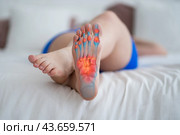 Joint diseases, hallux valgus, plantar fasciitis, heel spur, woman's leg hurts, pain in the foot, female feet closeup. Стоковое фото, фотограф Станислав Тарко / Фотобанк Лори