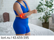 Diseases of the elbow joint, bone fracture, inflammation and dislocation, woman suffering from pain in cubit, dislocated arm. Стоковое фото, фотограф Станислав Тарко / Фотобанк Лори