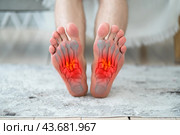 Joint diseases, hallux valgus, plantar fasciitis, man's leg hurts, pain in the foot. Стоковое фото, фотограф Станислав Тарко / Фотобанк Лори