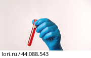 Blood test for the monkey pox virus. A laboratory assistant holds a test tube with blood in his hands, a suspicion of the monkey pox virus. The concept of the smallpox pandemic and viral infection. Стоковая иллюстрация, иллюстратор Скрипачев Антон / Фотобанк Лори