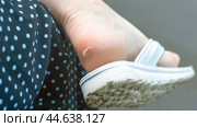 A woman's foot in white flip-flops and a callus on the heel. Стоковое фото, фотограф Скрипачев Антон / Фотобанк Лори