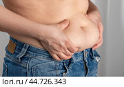 Woman hand holding excessive belly fat, overweight concept. woman pinching her fat on her waist. after pregnancy. skin stretch marks fat woman belly. Стоковое фото, фотограф Павел Муравьев / Фотобанк Лори