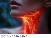 Thyroid gland inflammation, woman with pain in neck, sore throat and cough. Стоковое AI-изображение, AI-художник Станислав Тарко / Фотобанк Лори