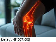 Knee pain, joint inflammation, bone fracture, woman suffering from osteoarthritis, leg injury, arthritis and degenerative changes. Стоковое AI-изображение, AI-художник Станислав Тарко / Фотобанк Лори
