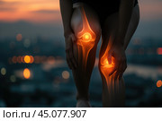 Knee pain, joint inflammation, bone fracture, woman suffering from osteoarthritis, leg injury, arthritis and degenerative changes. Стоковое AI-изображение, AI-художник Станислав Тарко / Фотобанк Лори