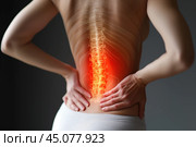Lumbar intervertebral spine hernia, woman with back pain on a gray background, spinal disc disease, health problems concept. Стоковое AI-изображение, AI-художник Станислав Тарко / Фотобанк Лори