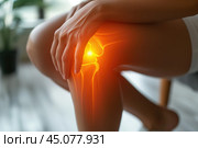 Knee pain, joint inflammation, bone fracture, woman suffering from osteoarthritis, leg injury, arthritis and degenerative changes. Стоковое AI-изображение, AI-художник Станислав Тарко / Фотобанк Лори